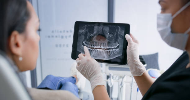 Licensed Tooth Extraction service in Canton, GA - Smile Center Dentistry